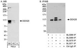 Detection of human DDX20 by western blot and immunoprecipitation.