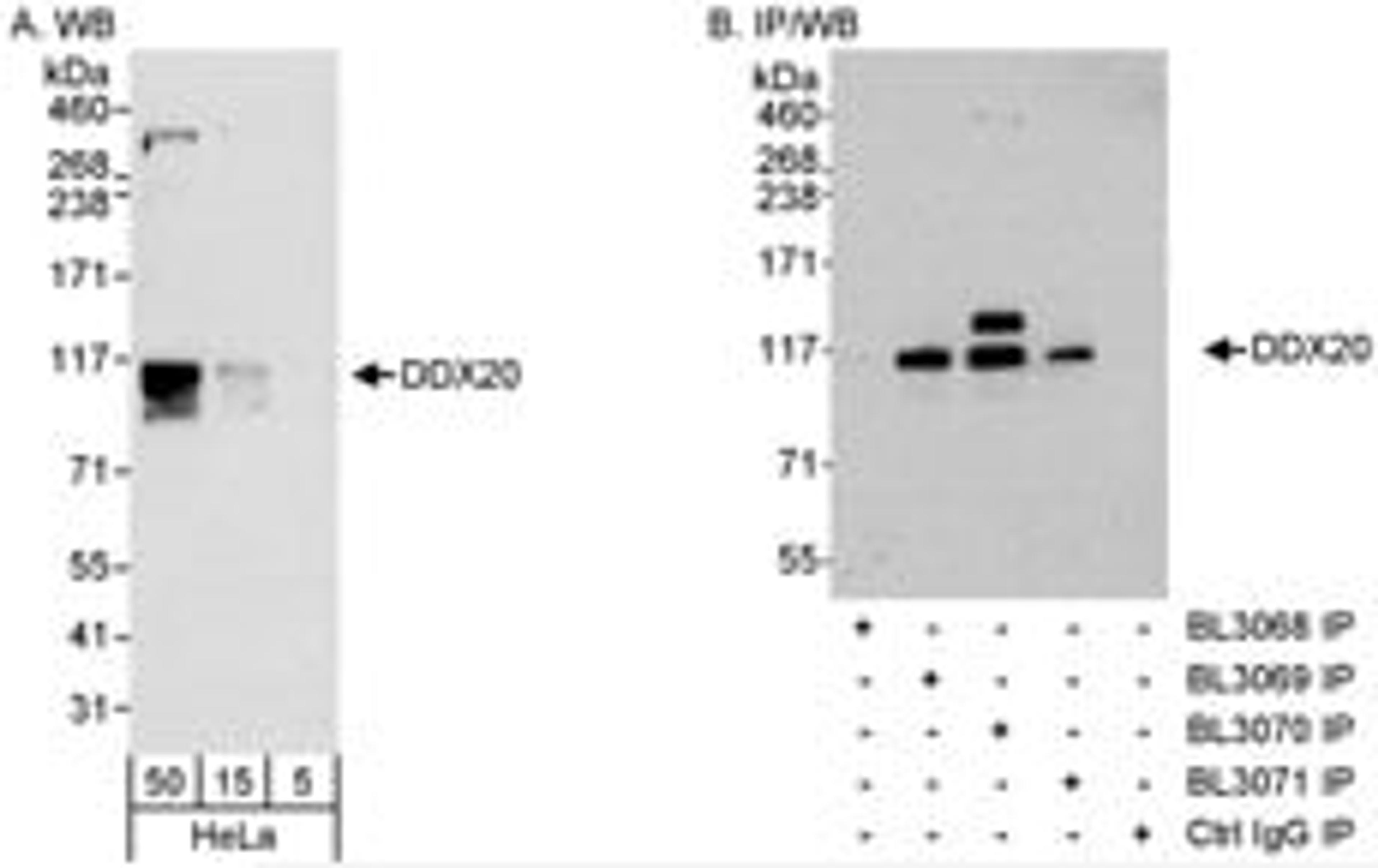 Detection of human DDX20 by western blot and immunoprecipitation.