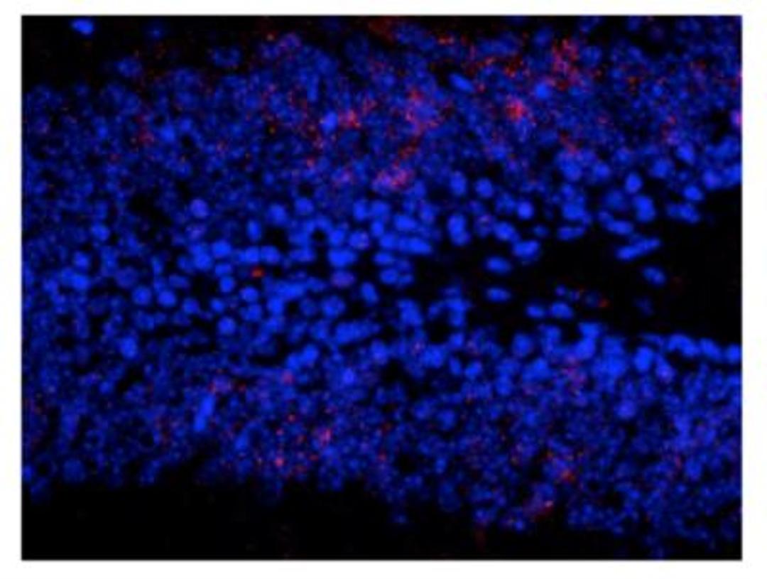 Immunohistochemistry: ERK1 [p Thr202, p Tyr204] Antibody [NB500-141] - Immunostaining of granule cells in the dentate gyrus of saline treated mouse showing ERK/MAPK when phosphorylated at Thr202/Tyr204 (red) and nuclei (blue). Photo courtesy of Robert Wine.