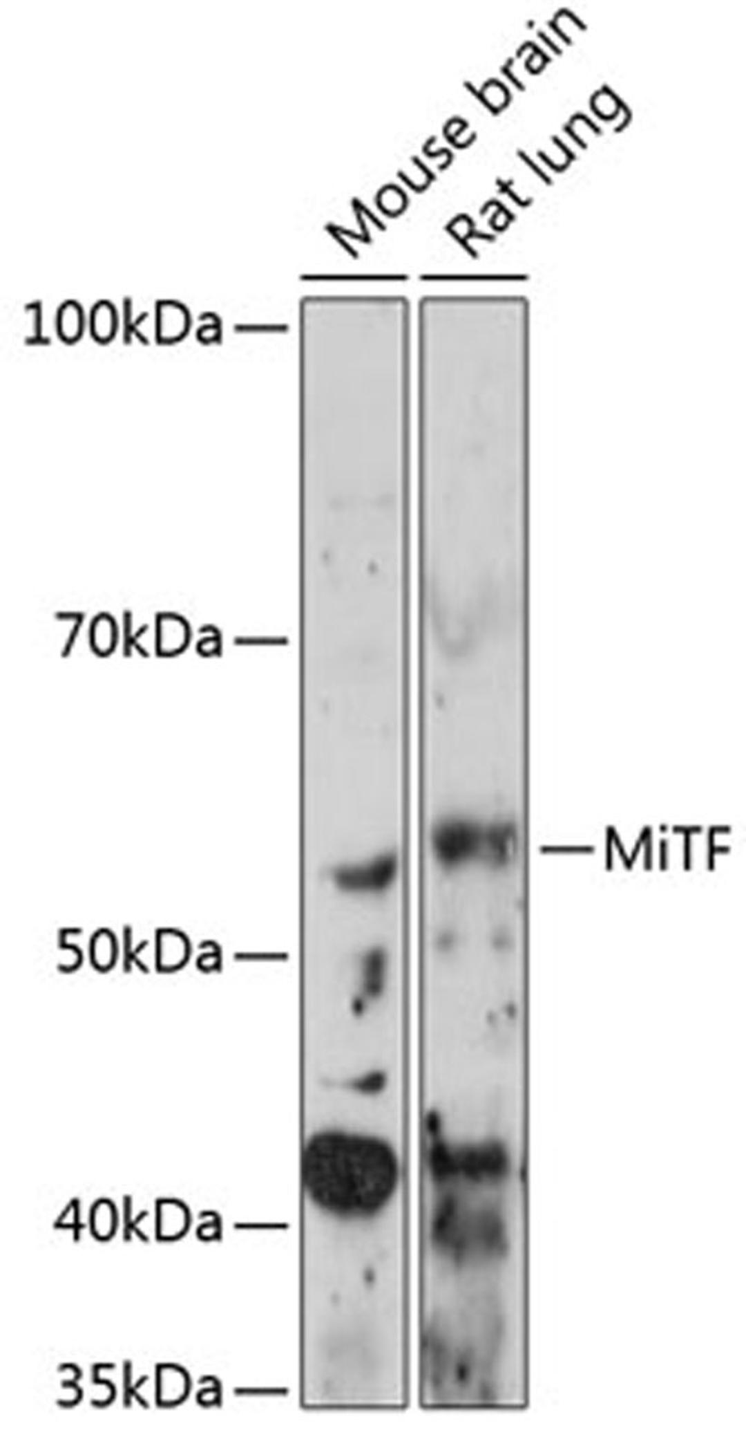 Western blot - MiTF Rabbit mAb (A11649)