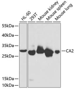 Western blot - CA2 antibody (A1440)