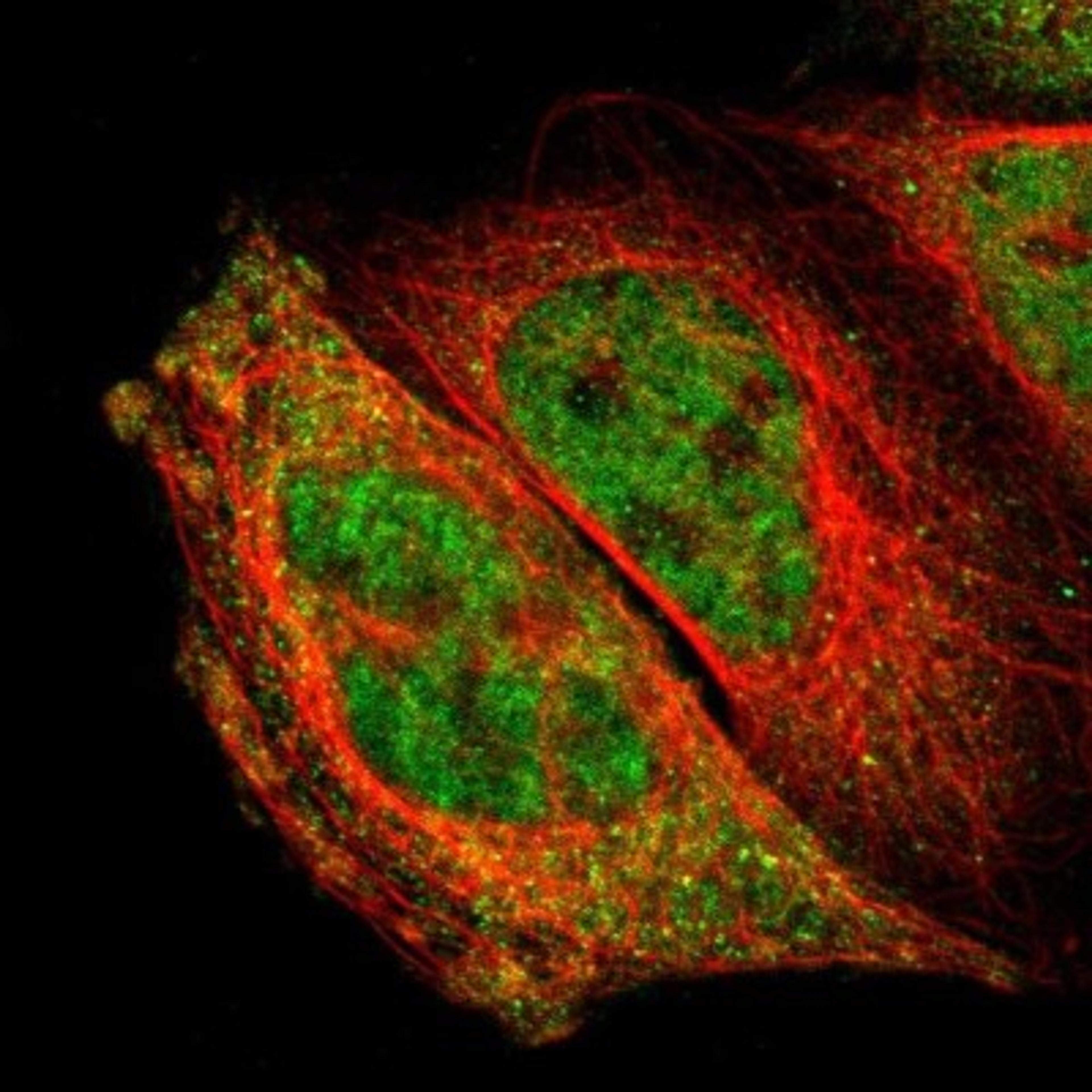 Immunocytochemistry/Immunofluorescence: LDOC1L Antibody [NBP1-85207] - Staining of human cell line A-431 shows positivity in nucleus but not nucleoli & cytoplasm.