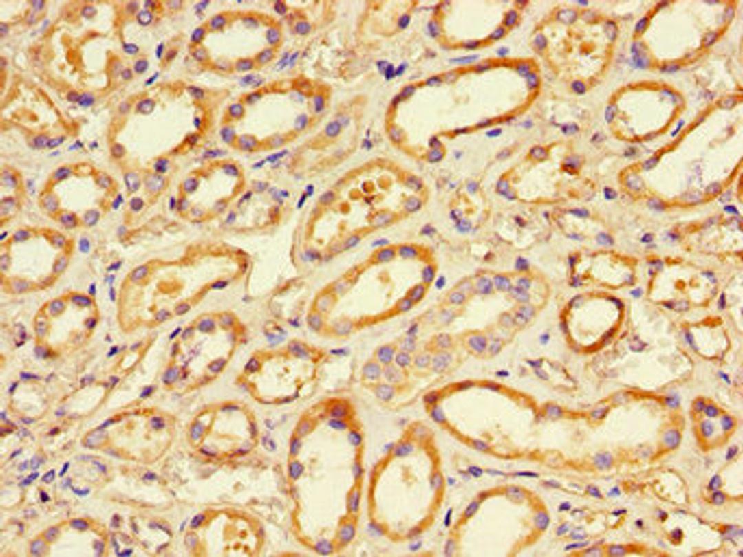 Immunohistochemistry of paraffin-embedded human renal tissue using CSB-PA15859A0Rb at dilution of 1:100