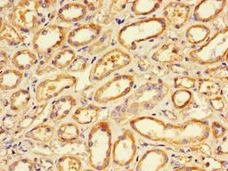 Immunohistochemistry of paraffin-embedded human renal tissue using CSB-PA15859A0Rb at dilution of 1:100