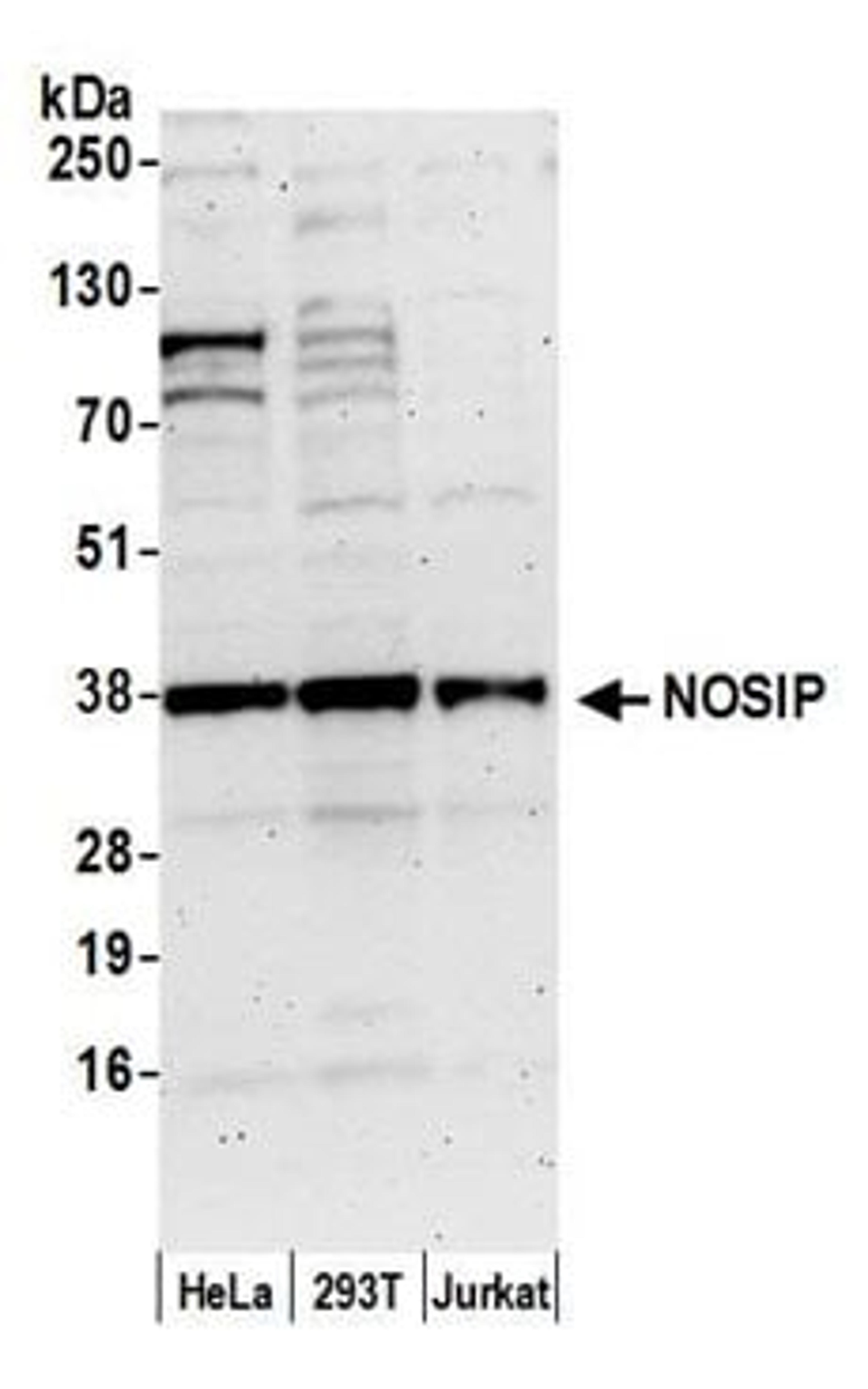 Detection of human NOSIP by western blot.