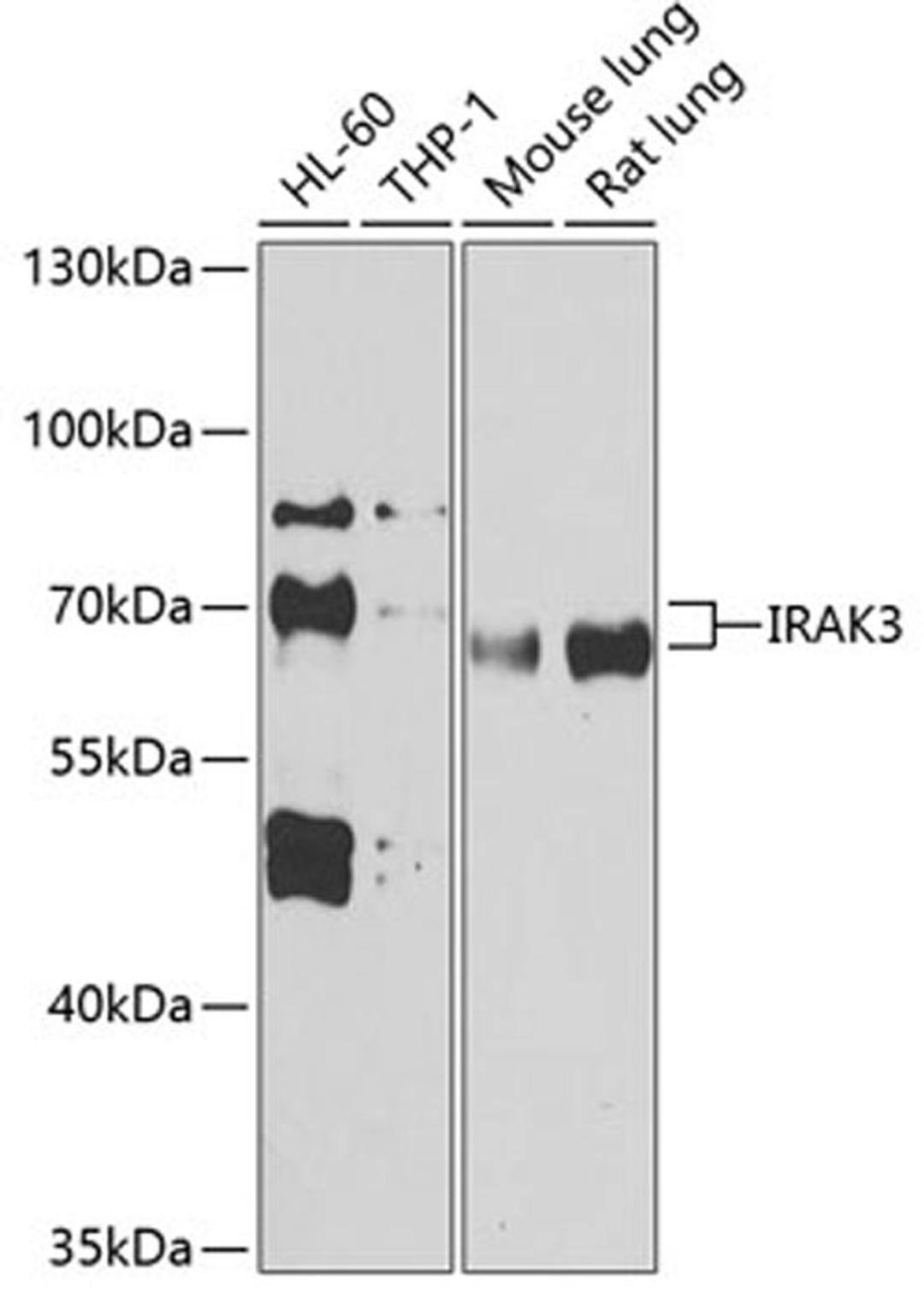 Western blot - IRAK3 antibody (A13402)