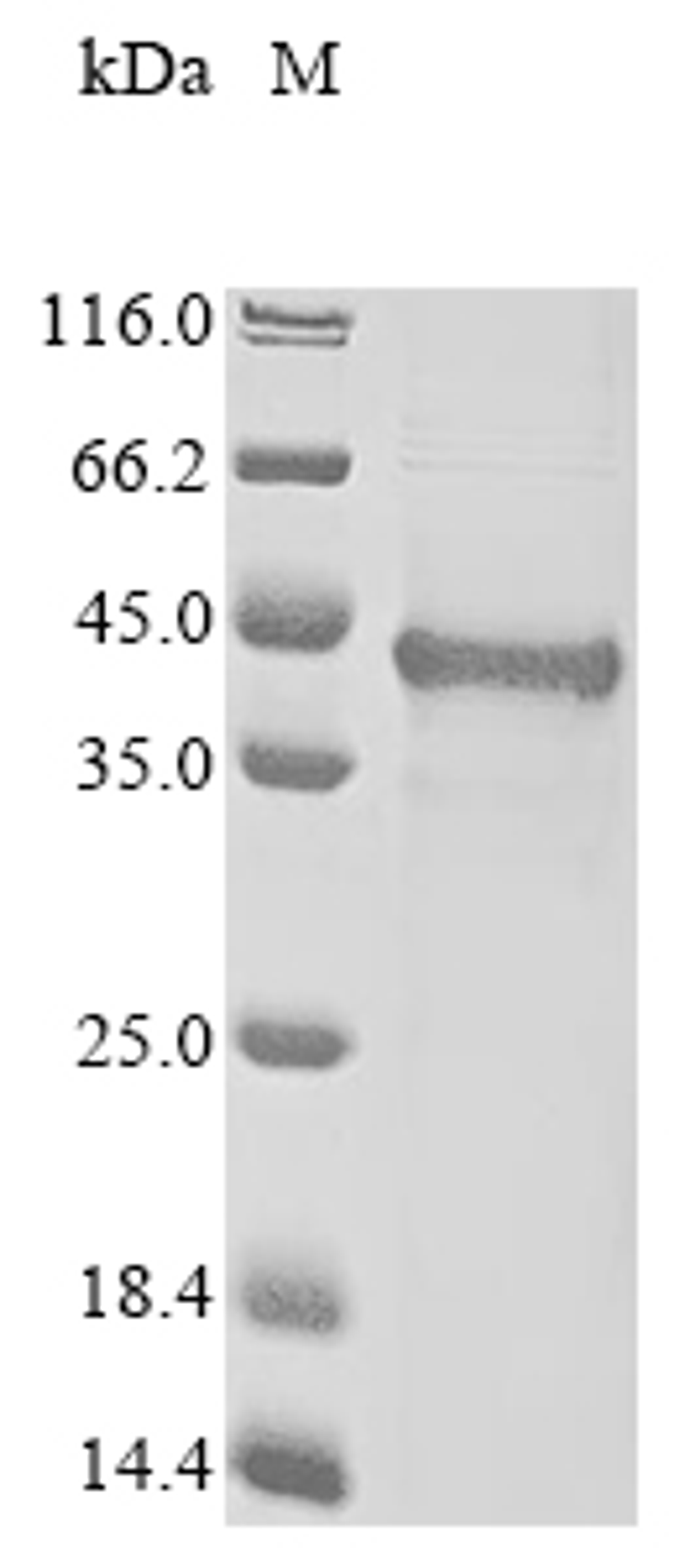 (Tris-Glycine gel) Discontinuous SDS-PAGE (reduced) with 5% enrichment gel and 15% separation gel.