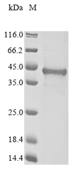 (Tris-Glycine gel) Discontinuous SDS-PAGE (reduced) with 5% enrichment gel and 15% separation gel.