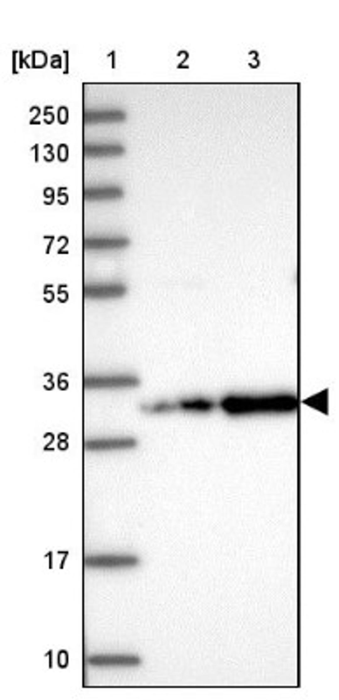 Western Blot: CCDC127 Antibody [NBP1-91756] - Lane 1: Marker [kDa] 250, 130, 95, 72, 55, 36, 28, 17, 10<br/>Lane 2: Human cell line RT-4<br/>Lane 3: Human cell line U-251MG sp