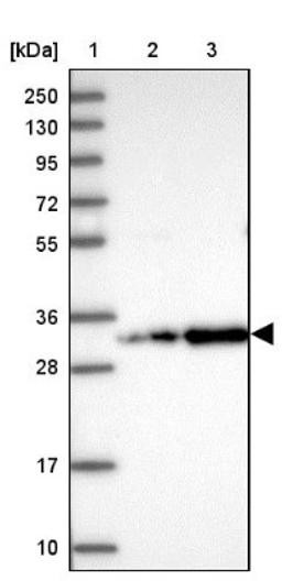 Western Blot: CCDC127 Antibody [NBP1-91756] - Lane 1: Marker [kDa] 250, 130, 95, 72, 55, 36, 28, 17, 10<br/>Lane 2: Human cell line RT-4<br/>Lane 3: Human cell line U-251MG sp