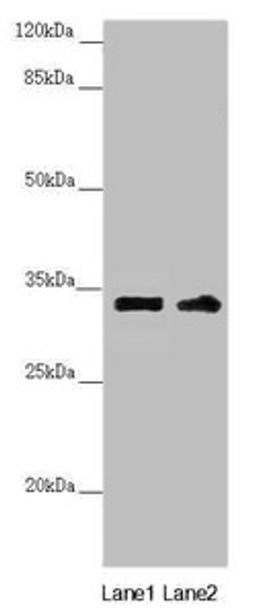 Western blot. All lanes: CENPK antibody at 3.98ug/ml. Lane 1: PC-3 whole cell lysate. Lane 2: 293T whole cell lysate. Secondary. Goat polyclonal to rabbit IgG at 1/10000 dilution. Predicted band size: 32 kDa. Observed band size: 32 kDa. 