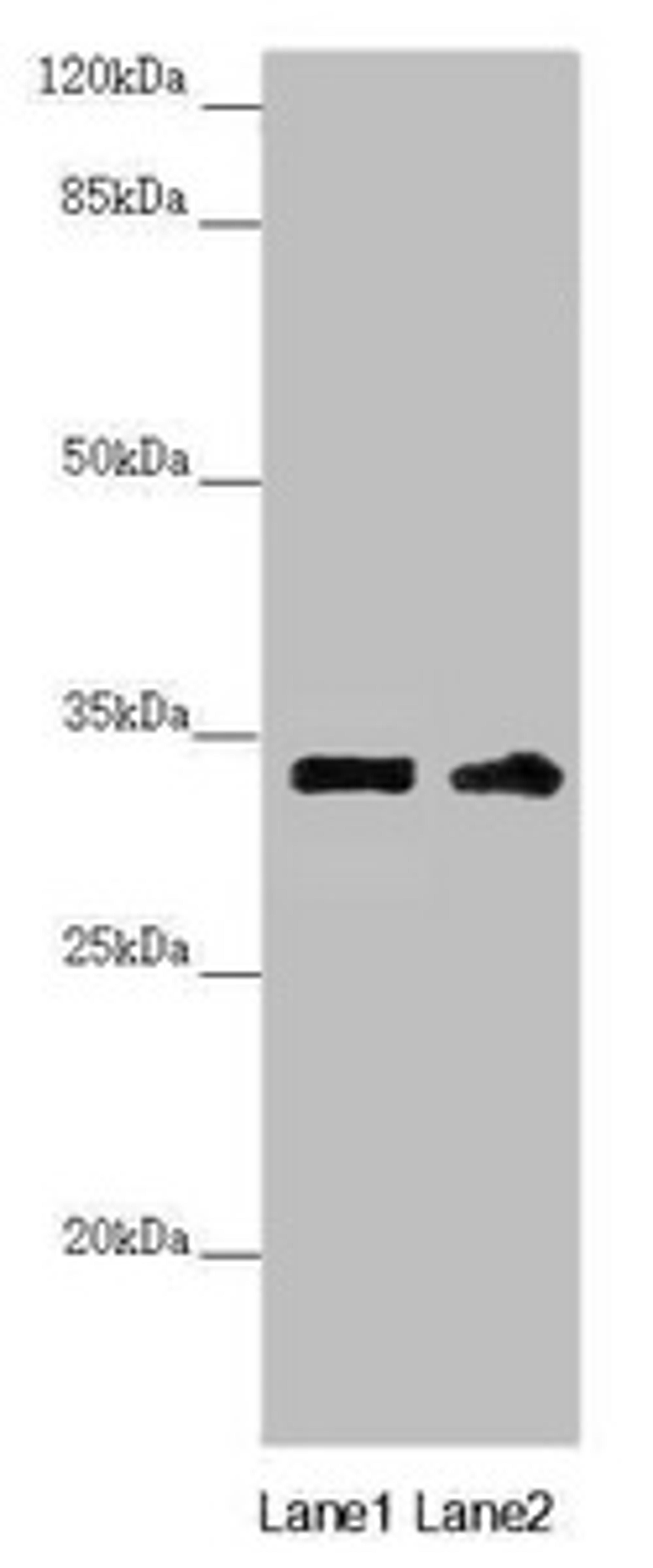 Western blot. All lanes: CENPK antibody at 3.98ug/ml. Lane 1: PC-3 whole cell lysate. Lane 2: 293T whole cell lysate. Secondary. Goat polyclonal to rabbit IgG at 1/10000 dilution. Predicted band size: 32 kDa. Observed band size: 32 kDa. 