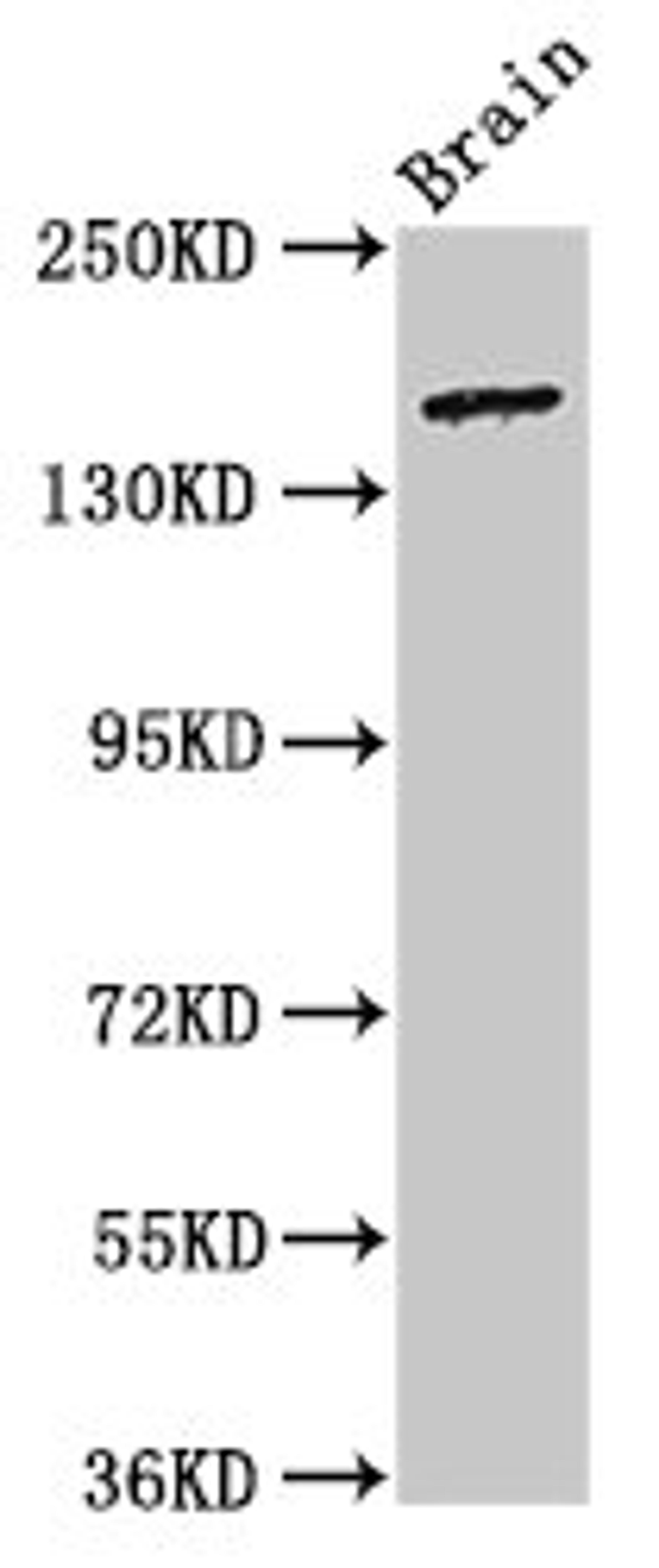 Western Blot. Positive WB detected in: Rat brain tissue. All lanes: ADGRB2 antibody at 3.2ug/ml. Secondary. Goat polyclonal to rabbit IgG at 1/50000 dilution. Predicted band size: 173, 172, 170 kDa. Observed band size: 173 kDa. 