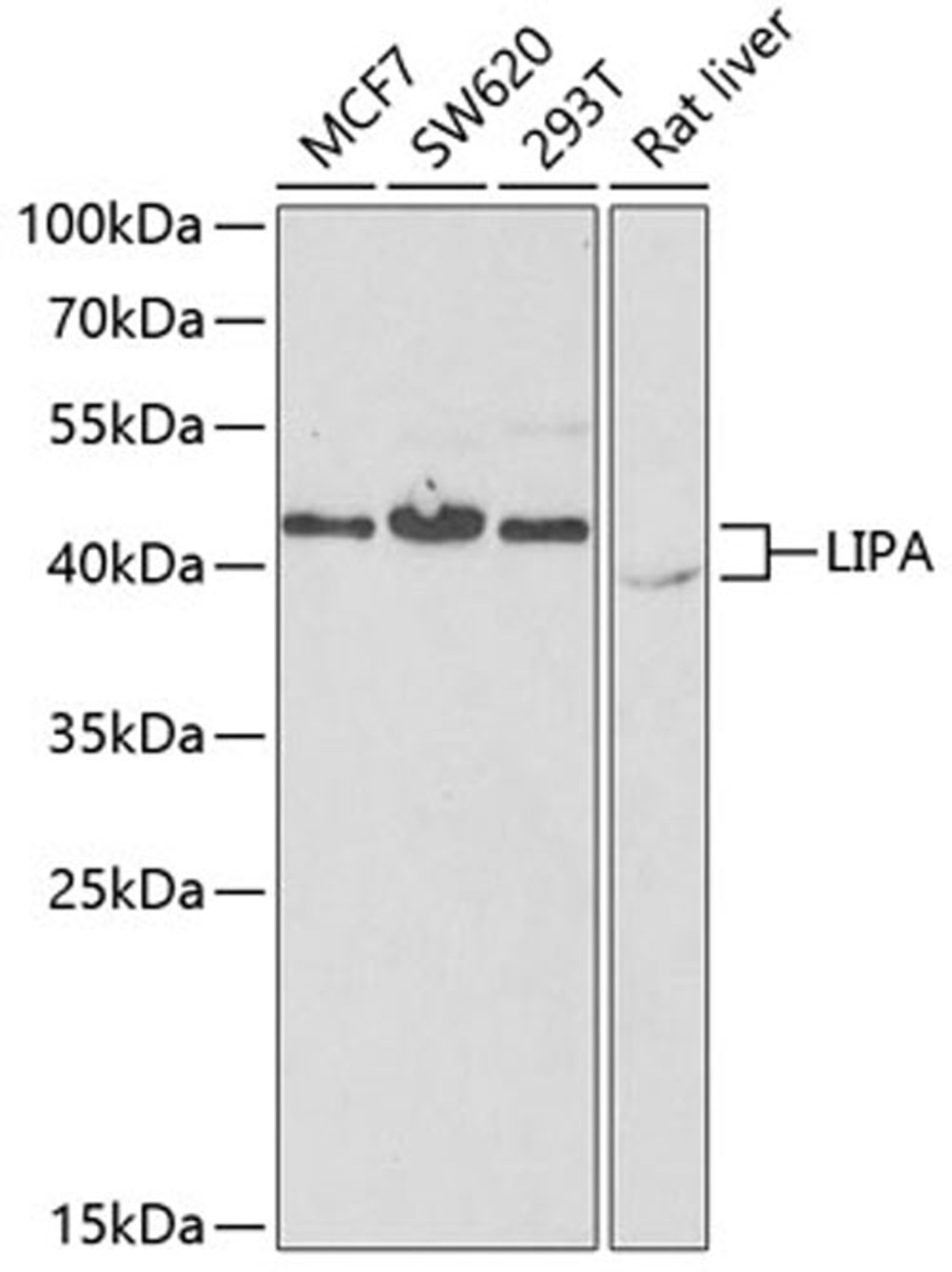 Western blot - LIPA antibody (A6385)