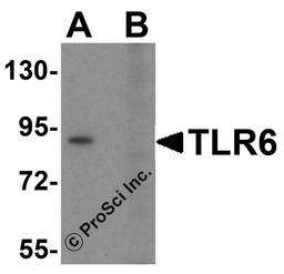 Western blot analysis of TLR6 in Daudi cell lysate with TLR6 antibody at 1 μg/mL in (A) the absence and (B) the presence of blocking peptide.