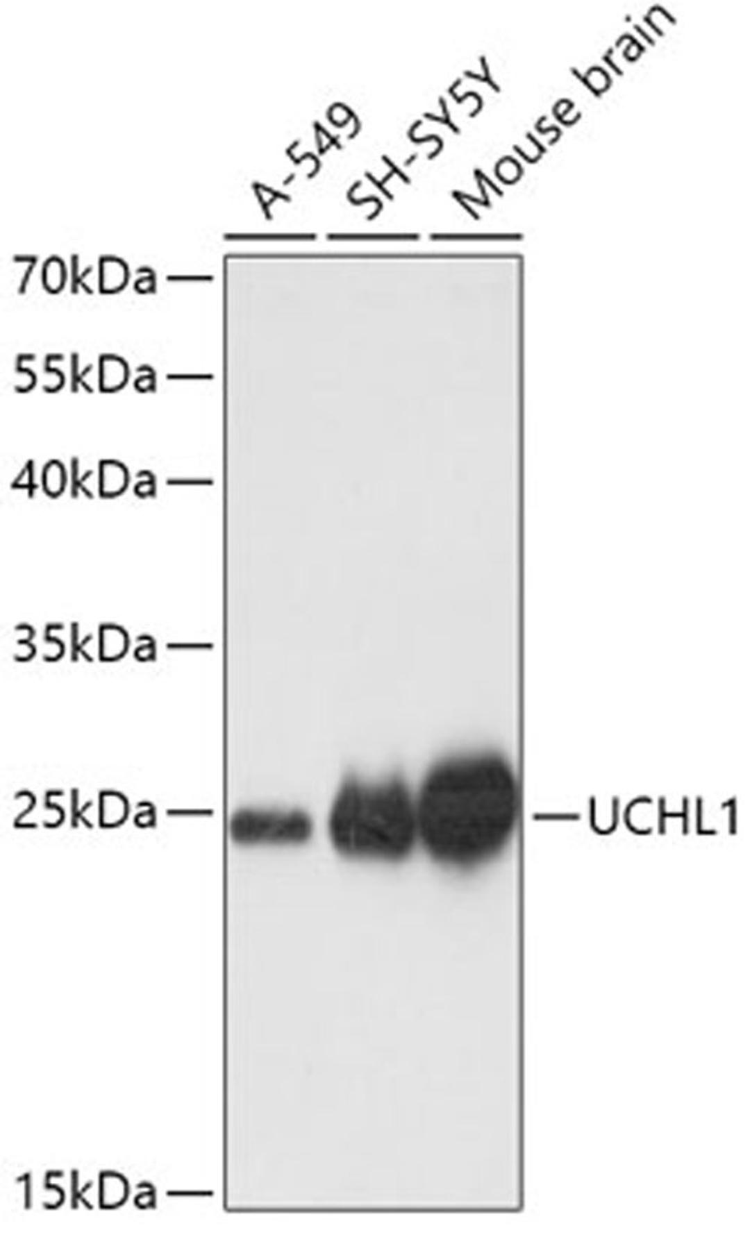 Western blot - UCHL1 antibody (A0148)