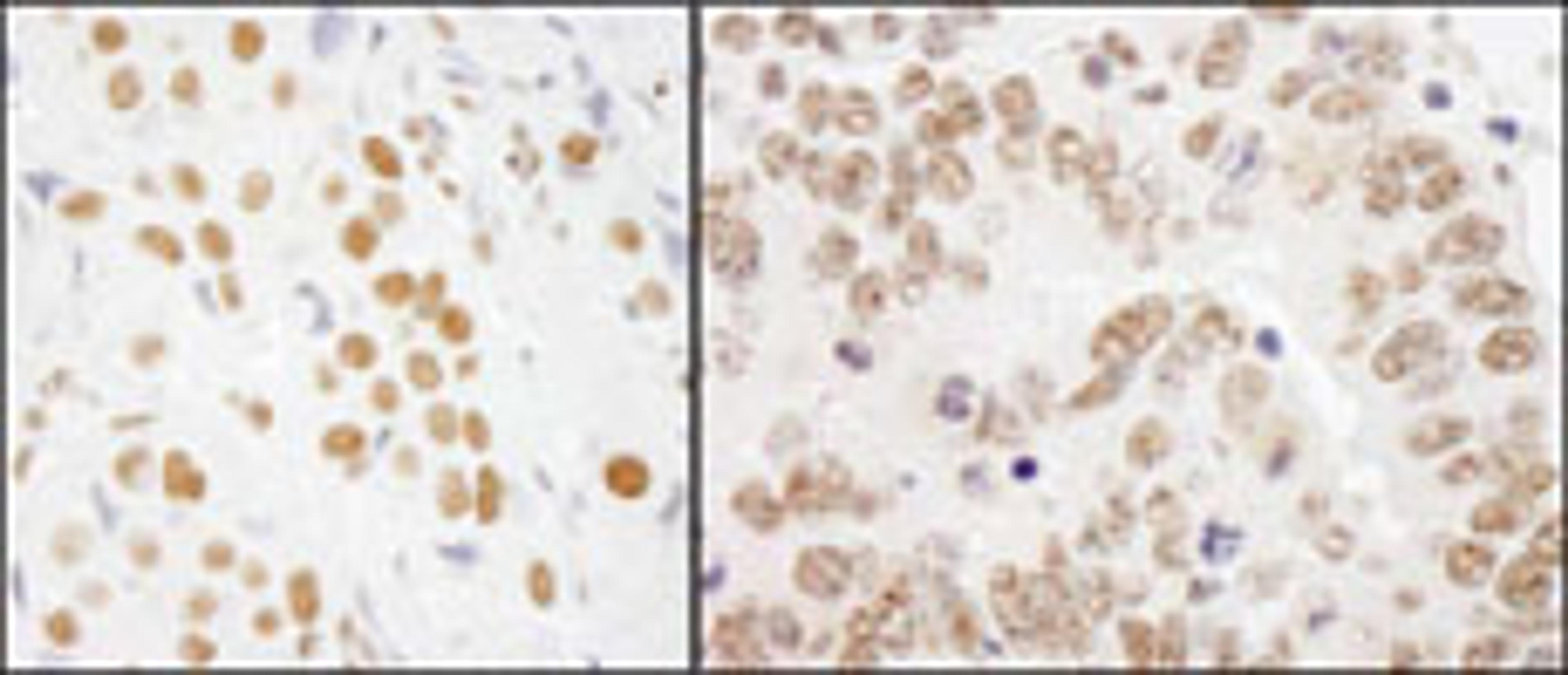 Detection of human and mouse RALY by immunohistochemistry.