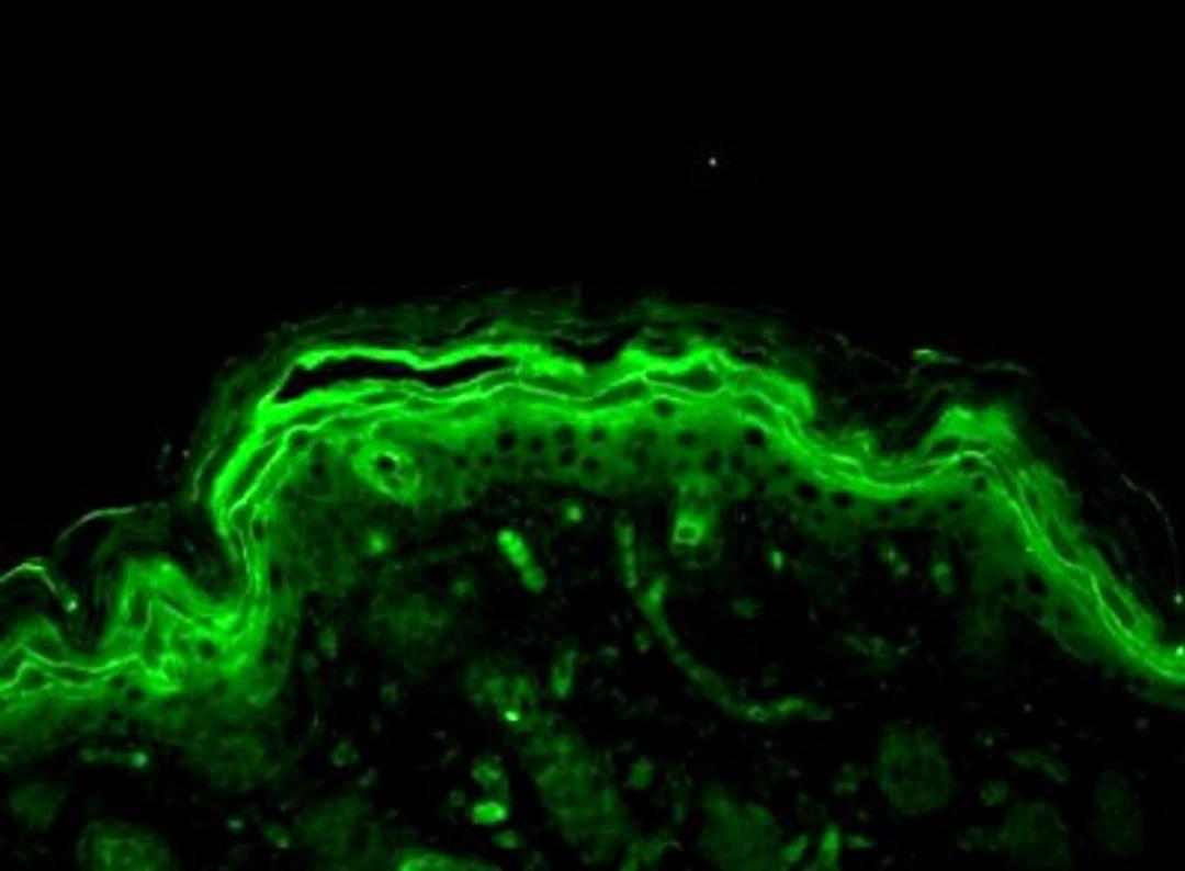 Immunohistochemistry-Paraffin: ERK1/2 Antibody [NB110-96887] - Bouin's fixed paraffin embedded backskin sections of transgenic mice. Courtesy of Dr. Turksen, Ottawa Hospital Research Institute, Canada.