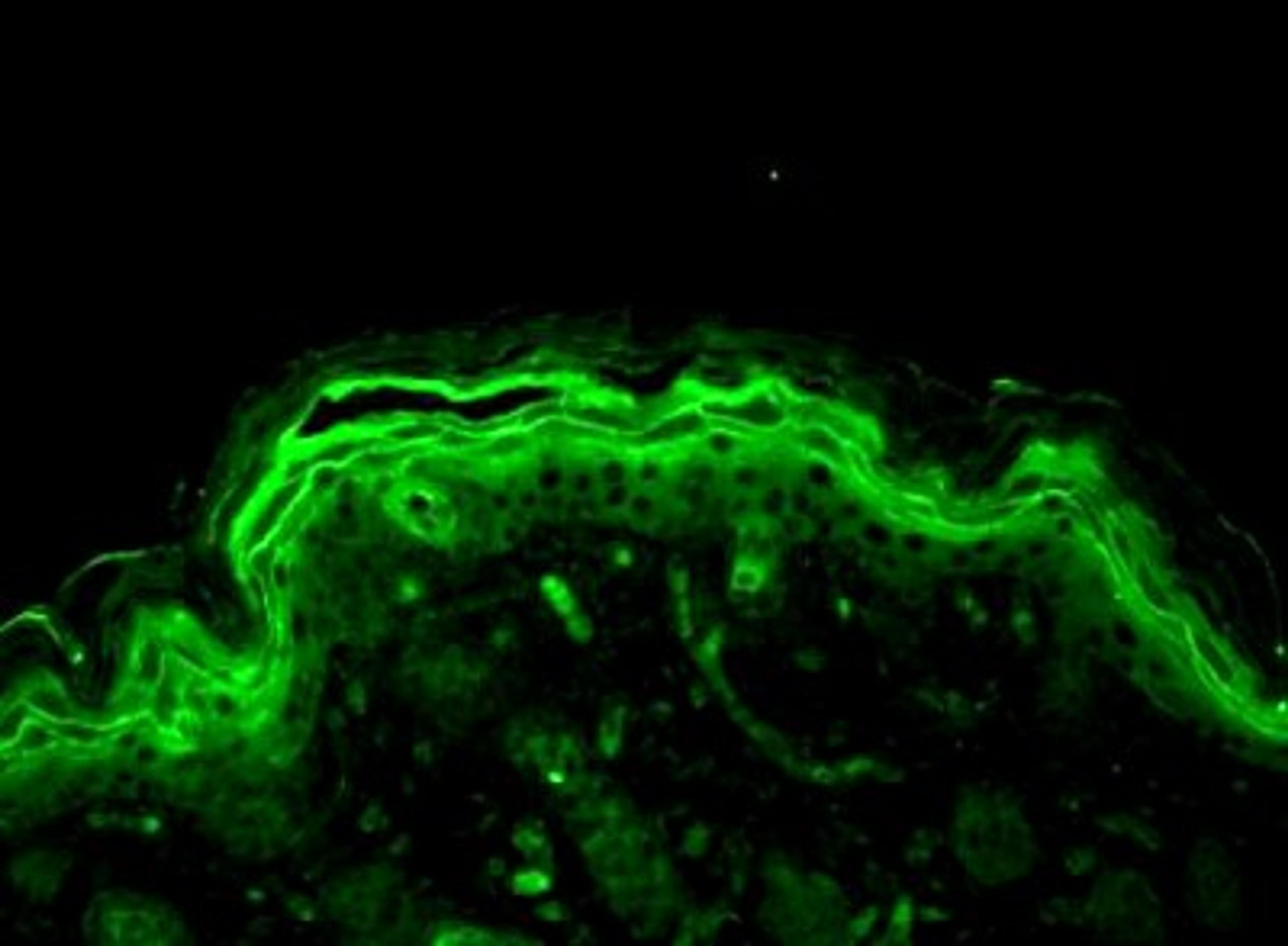 Immunohistochemistry-Paraffin: ERK1/2 Antibody [NB110-96887] - Bouin's fixed paraffin embedded backskin sections of transgenic mice. Courtesy of Dr. Turksen, Ottawa Hospital Research Institute, Canada.