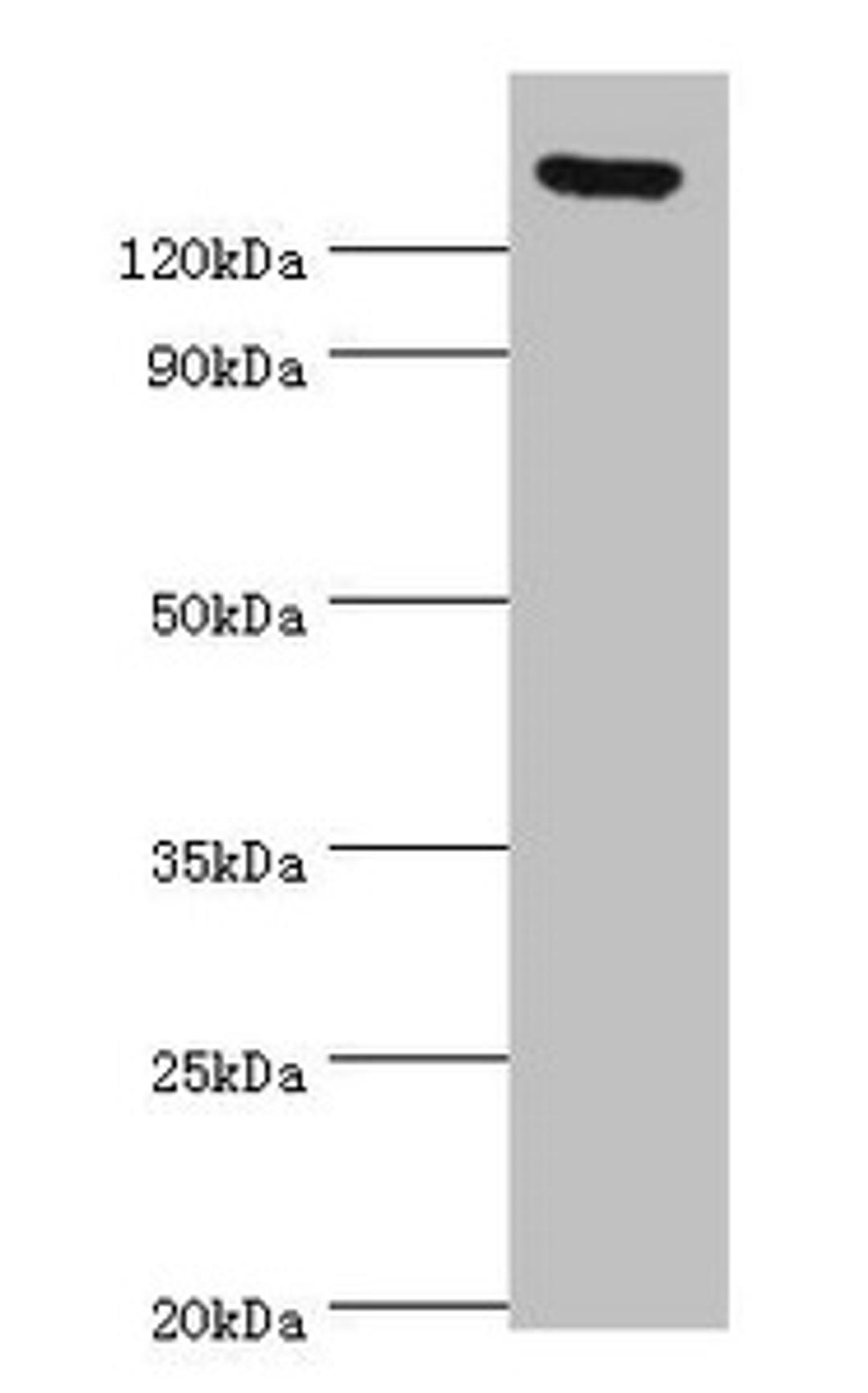 Western blot. All lanes: SPAG5 antibody at 2ug/ml. Secondary. Goat polyclonal to rabbit IgG at 1/10000 dilution. Predicted band size: 134 kDa. Observed band size: 134 kDa.