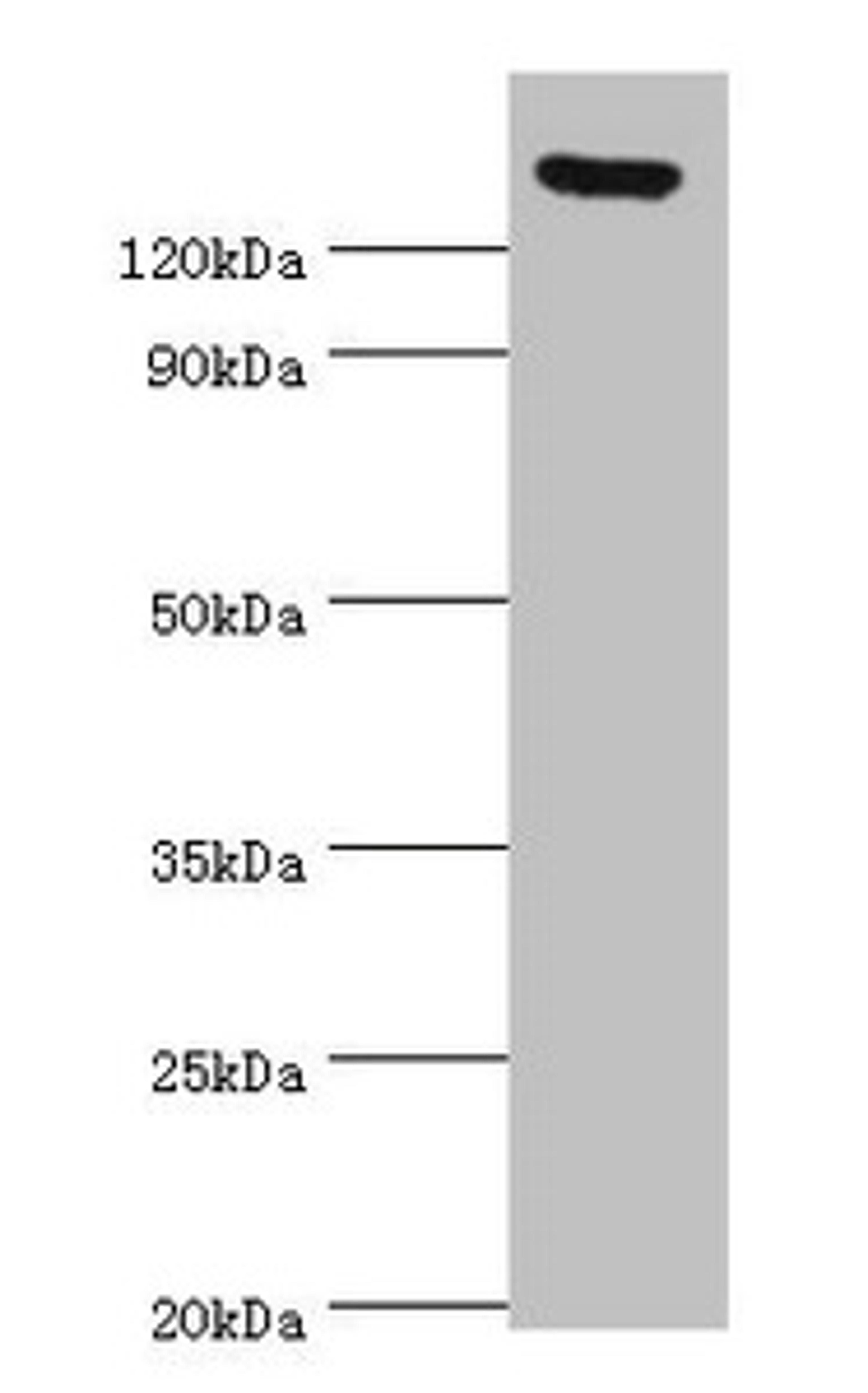 Western blot. All lanes: SPAG5 antibody at 2ug/ml. Secondary. Goat polyclonal to rabbit IgG at 1/10000 dilution. Predicted band size: 134 kDa. Observed band size: 134 kDa.