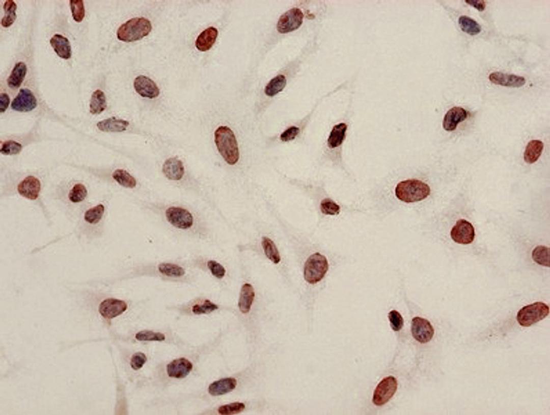Immunocytochemistry analysis of Hela cells using CSB-PA010429PA08acHU at dilution of 1:100
