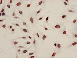 Immunocytochemistry analysis of Hela cells using CSB-PA010429PA08acHU at dilution of 1:100