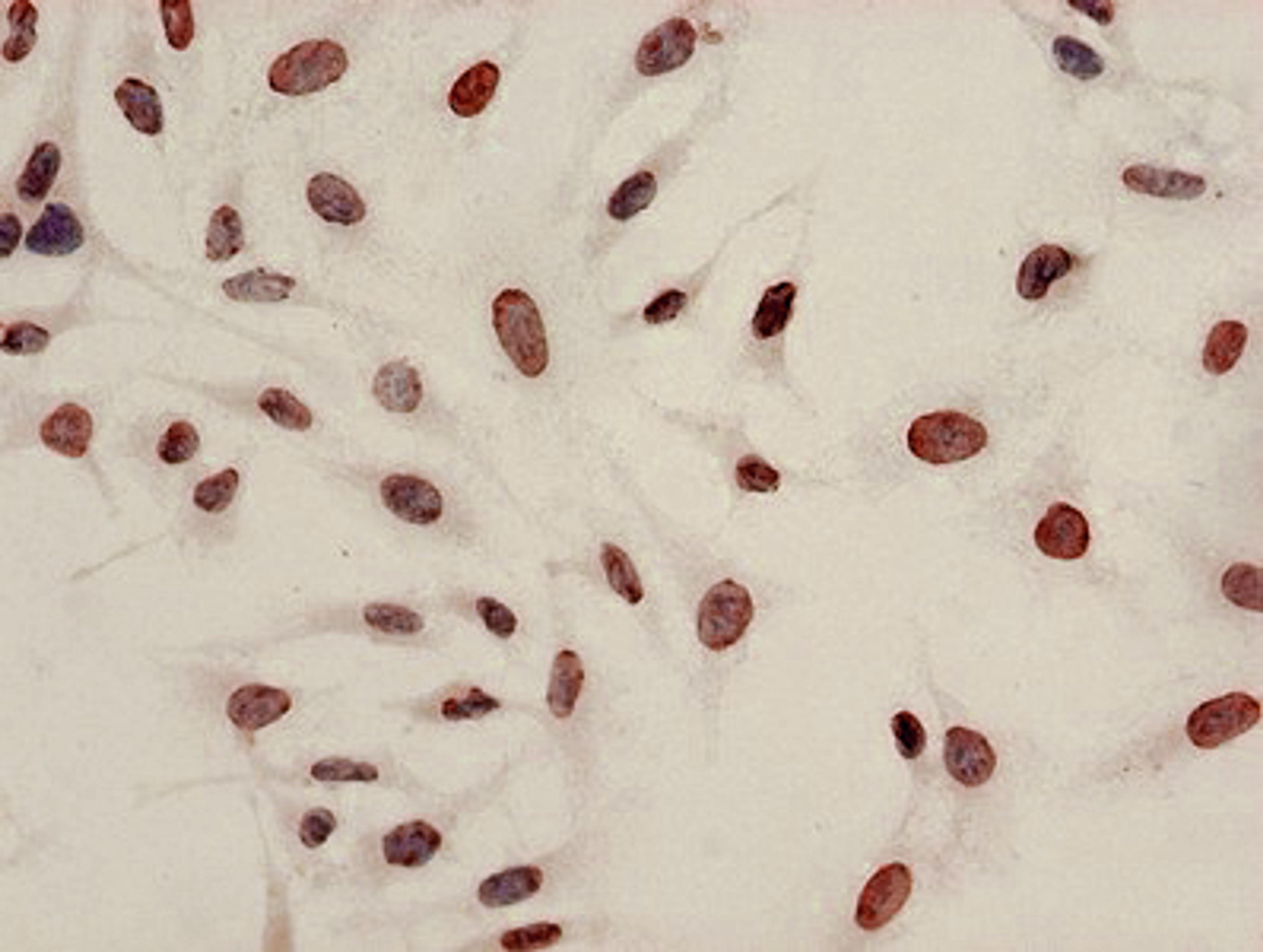 Immunocytochemistry analysis of Hela cells using CSB-PA010429PA08acHU at dilution of 1:100