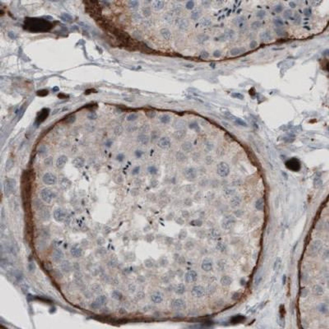 Immunohistochemistry: LAMA1 Antibody (CL2968) [NBP2-42384] - Staining of human testis shows strong immunoreactivity in basement membrane of seminiferous tubules.