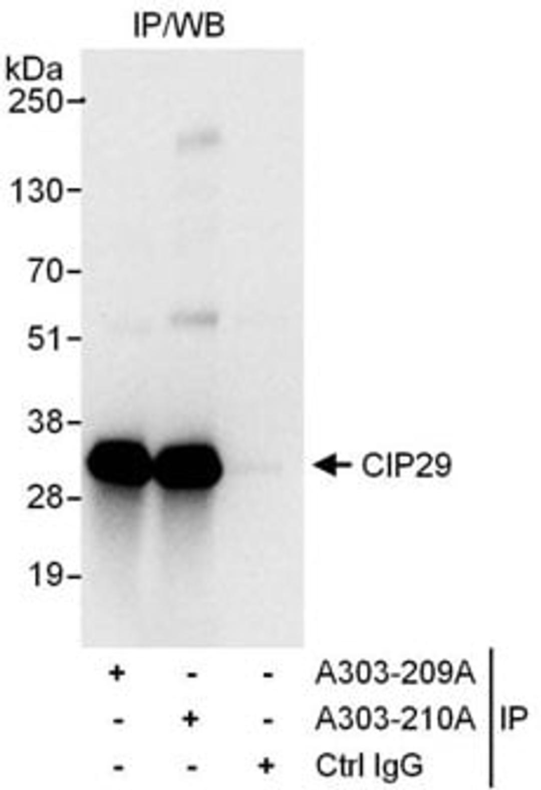 Detection of human CIP29 by western blot of immunoprecipitates.