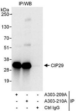 Detection of human CIP29 by western blot of immunoprecipitates.