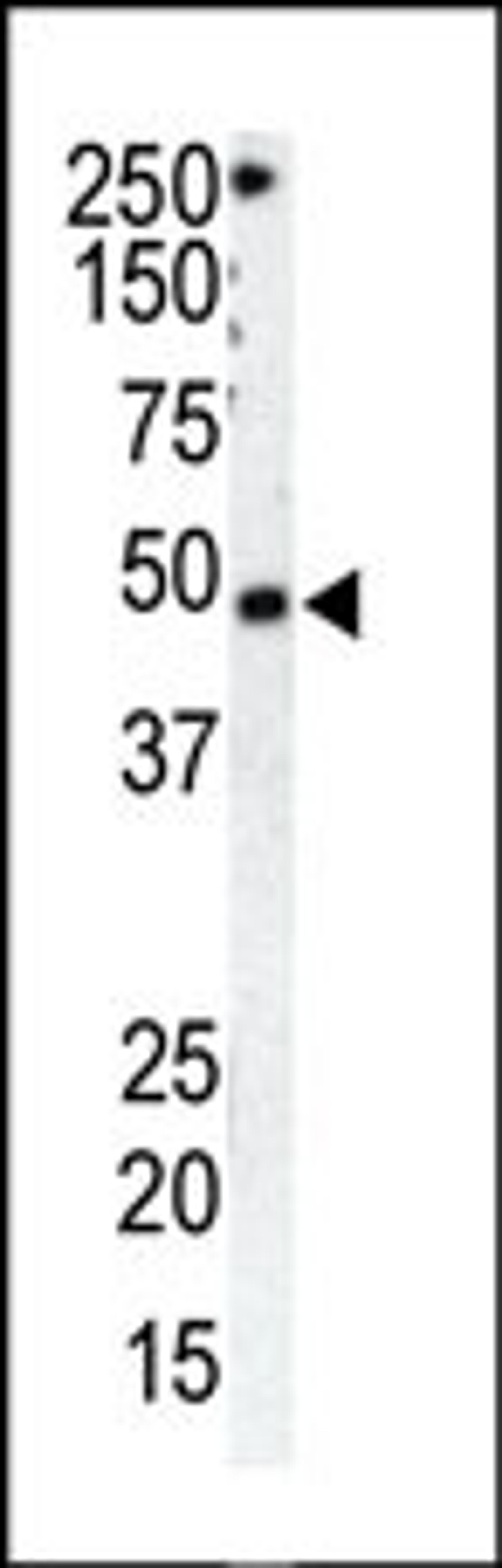 Antibody is used in Western blot to detect GRK1 in HeLa cell lysate (Lane 1) and mouse spleen tissue lysate (Lane 2).