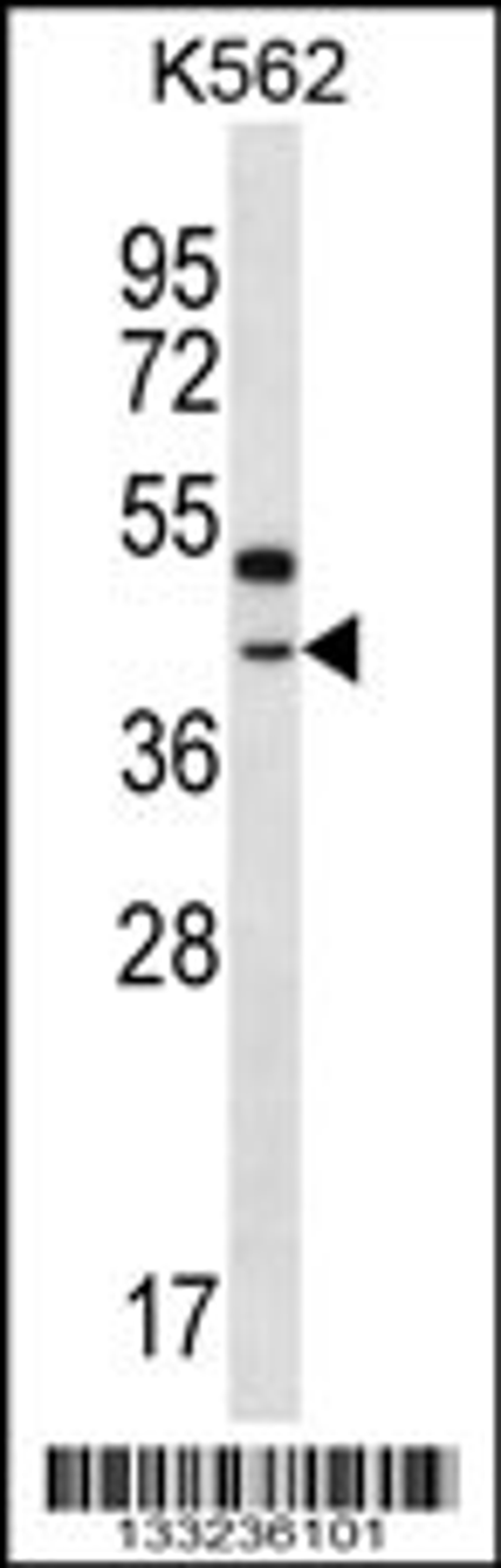 Western blot analysis in K562 cell line lysates (35ug/lane).