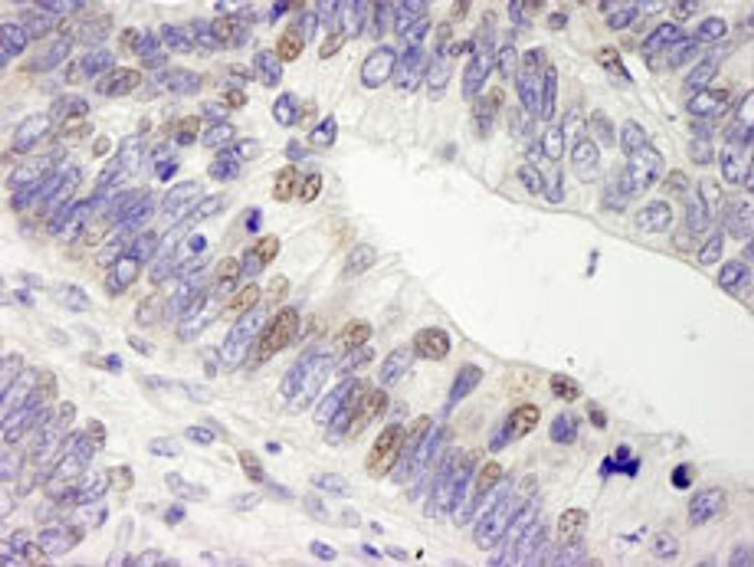 Detection of human USP28 by immunohistochemistry.