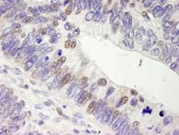 Detection of human USP28 by immunohistochemistry.