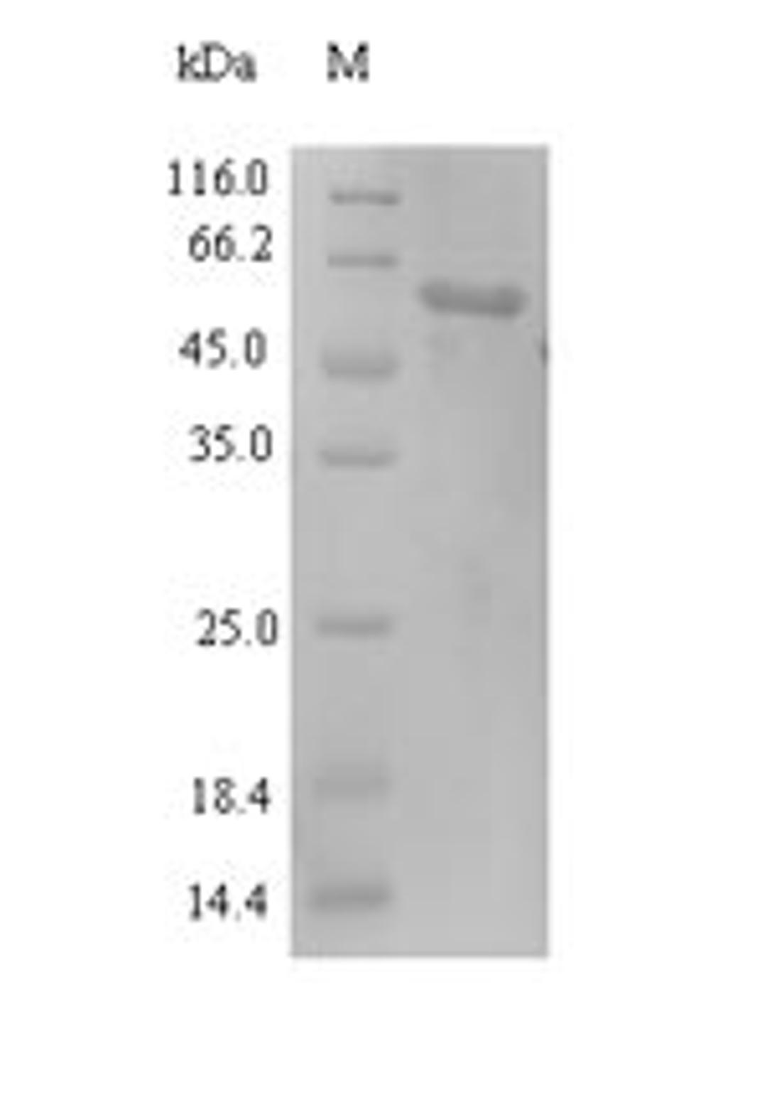(Tris-Glycine gel) Discontinuous SDS-PAGE (reduced) with 5% enrichment gel and 15% separation gel.
