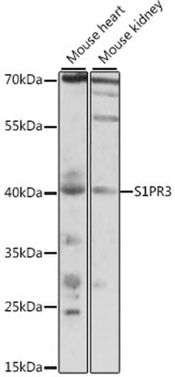 Western blot - S1PR3 antibody (A15664)