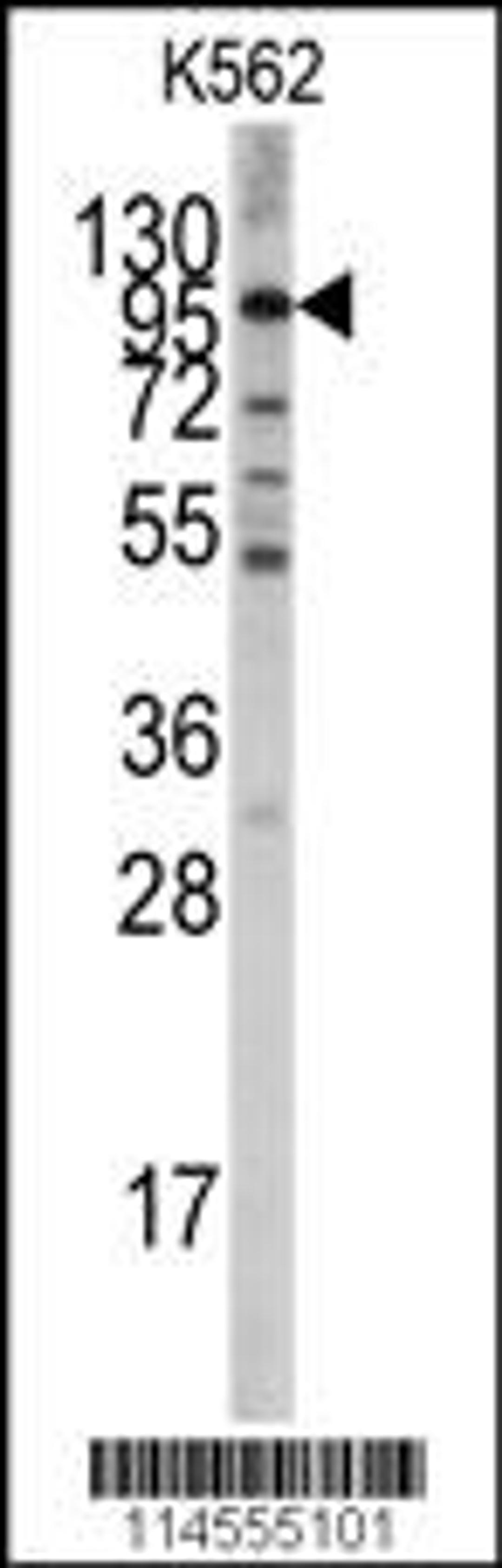 Western blot analysis of in K562 cell line lysates (35ug/lane).