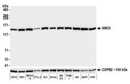 Detection of mouse SMC3 by western blot.