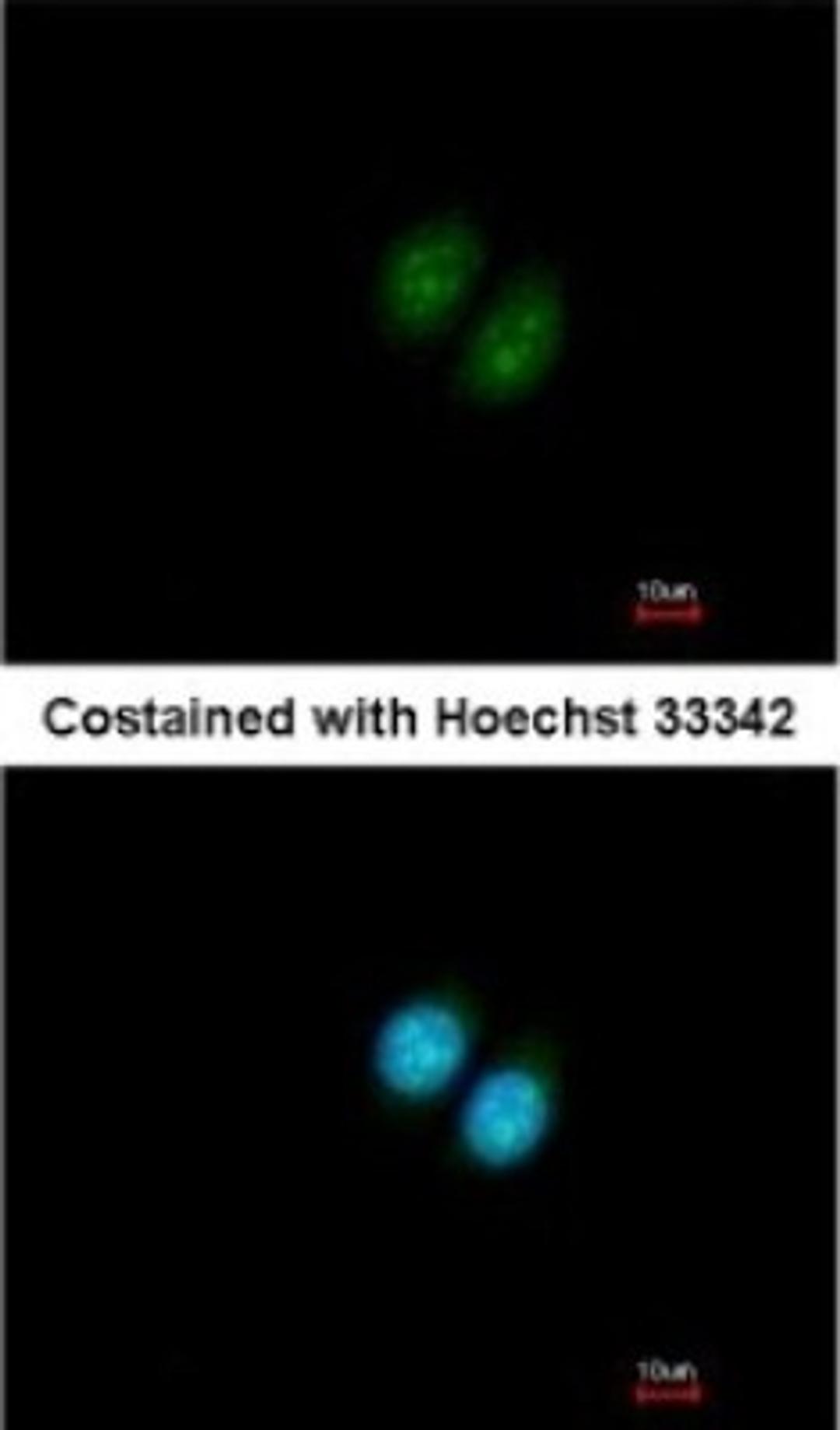 Immunocytochemistry/Immunofluorescence: RRP12 Antibody [NBP2-15105] - Paraformaldehyde-fixed MCF-7, using antibody at 1:200 dilution.