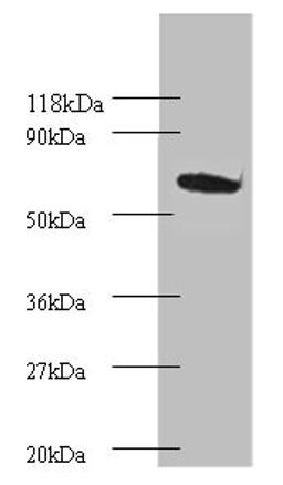 Western blot. All lanes: Proteasome subunit beta type-4 Antibody at 2µg/ml + EC109 whole cell lysate. Secondary. Goat polyclonal to rabbit IgG at 1/15000 dilution. Predicted band size: 30 kDa. Observed band size: 75 kDa