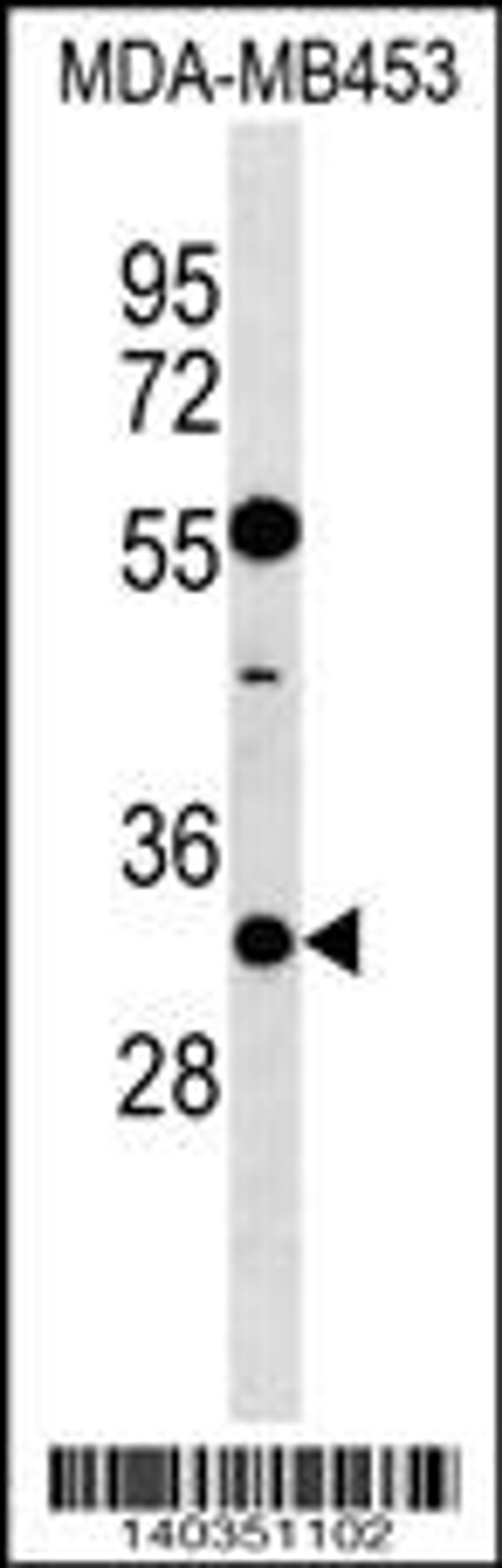 Western blot analysis in MDA-MB453 cell line lysates (35ug/lane).