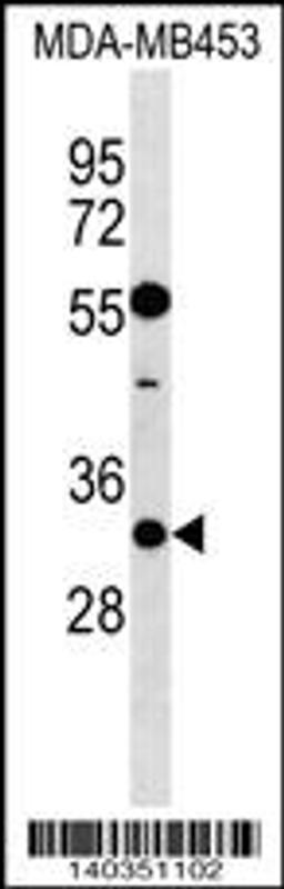 Western blot analysis in MDA-MB453 cell line lysates (35ug/lane).