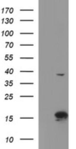 Western Blot: ATXN7L1 Antibody (4F6) [NBP2-46558] - Analysis of HEK293T cells were transfected with the pCMV6-ENTRY control (Left lane) or pCMV6-ENTRY ATXN7L1 .