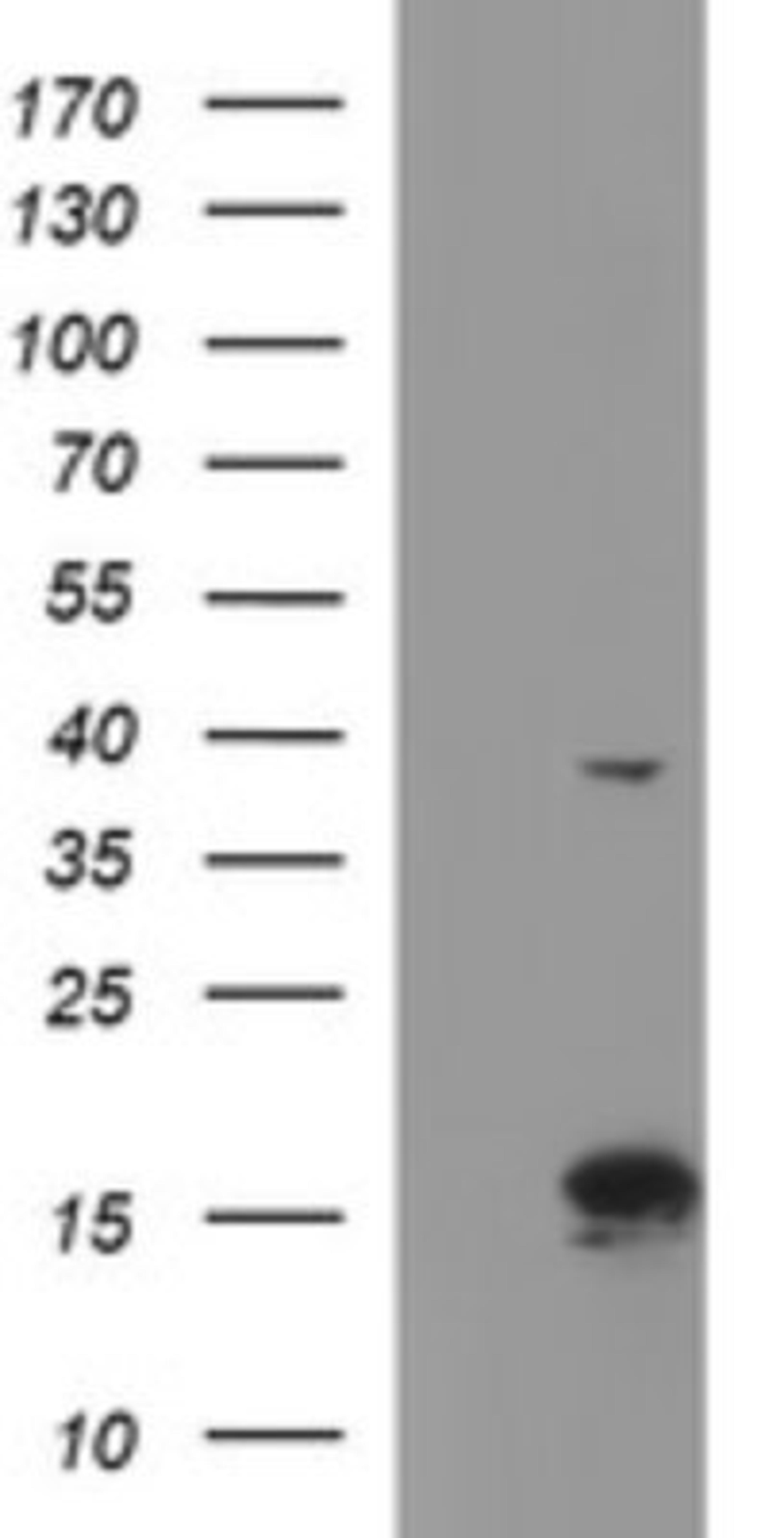 Western Blot: ATXN7L1 Antibody (4F6) [NBP2-46558] - Analysis of HEK293T cells were transfected with the pCMV6-ENTRY control (Left lane) or pCMV6-ENTRY ATXN7L1 .