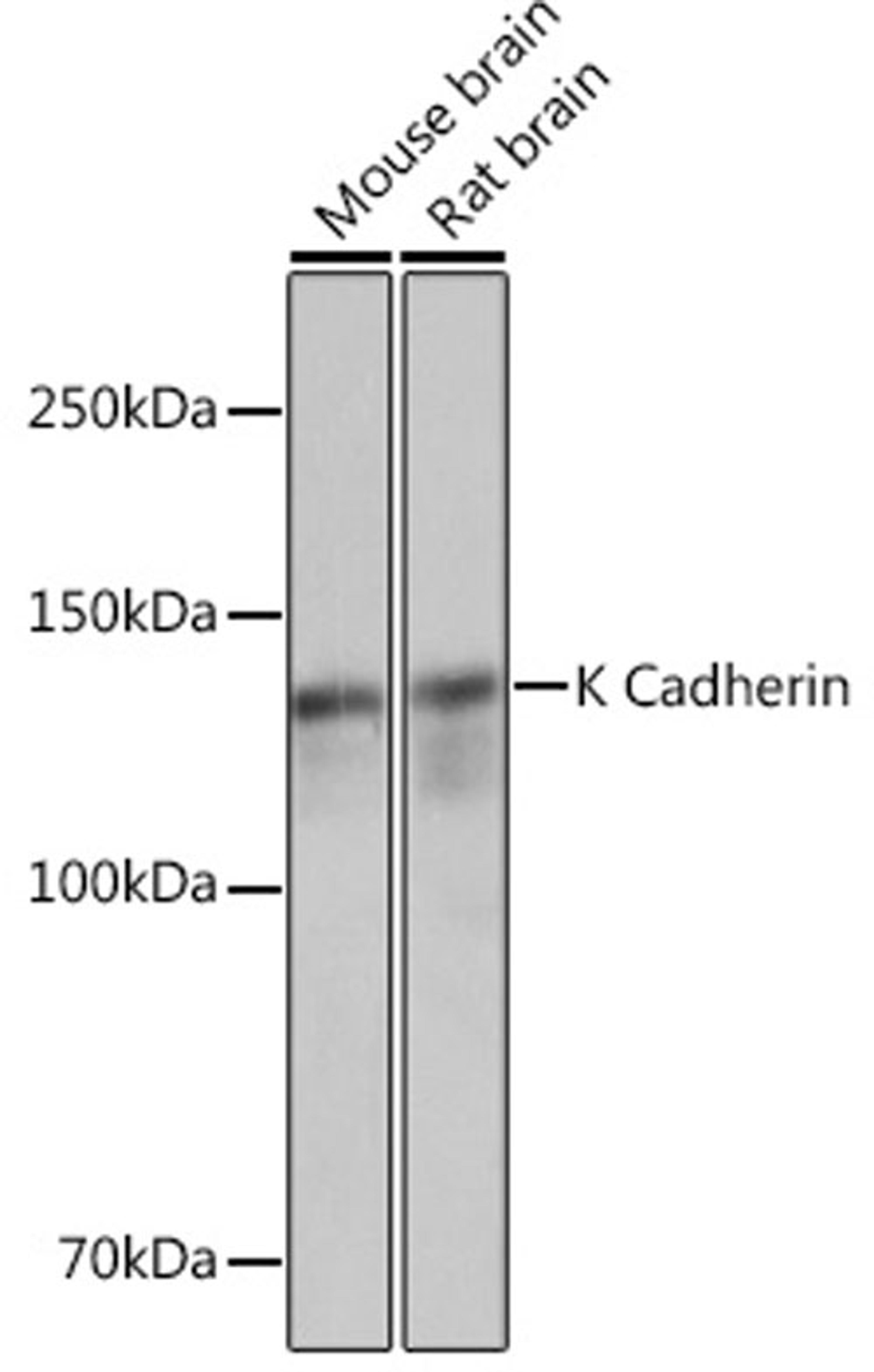 Western blot - K Cadherin Rabbit mAb (A4689)