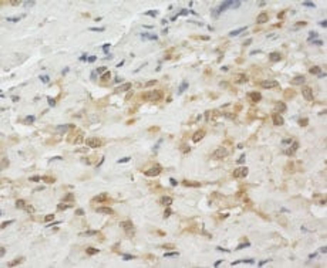 Detection of human LPP by immunohistochemistry.