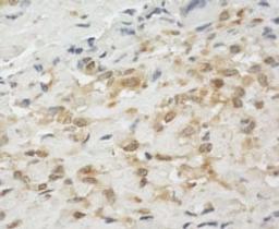 Detection of human LPP by immunohistochemistry.