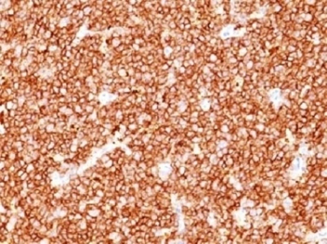 IHC testing of FFPE human tonsil with CD10 antibody (clone MME/1709). Required HEIR: boil tissue sections in 10mM Tris with 1mM EDTA, pH 9, for 10-20 min.