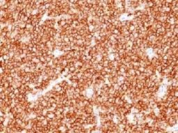 IHC testing of FFPE human tonsil with CD10 antibody (clone MME/1709). Required HEIR: boil tissue sections in 10mM Tris with 1mM EDTA, pH 9, for 10-20 min.